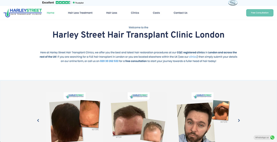 Harley street hair transplant clinic