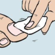 How to use nail medication graphic