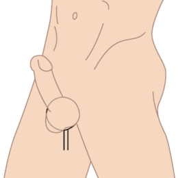 Stretchy silicone cock ring graphic