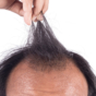 Man with receding hairline