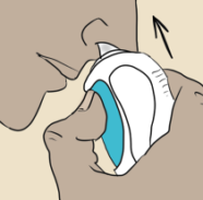Insert spray into nose graphic